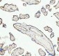 Anti-beta Catenin CTNNB1 Rabbit Monoclonal Antibody